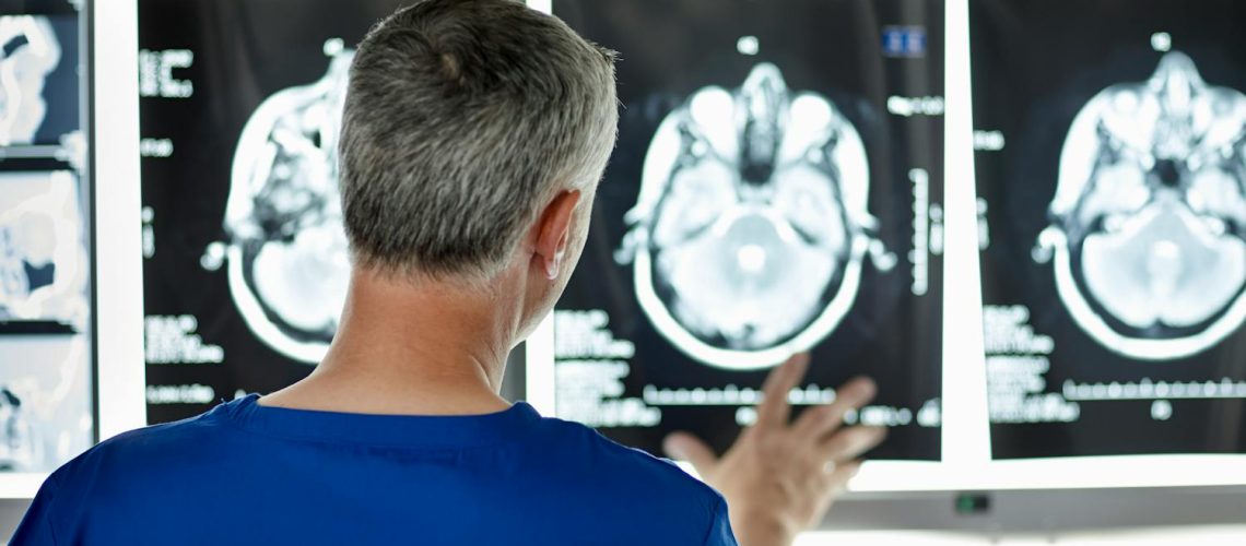 Hématome sous-dural : symptômes, causes et traitements Hématome sous-dural : symptômes, causes et traitements